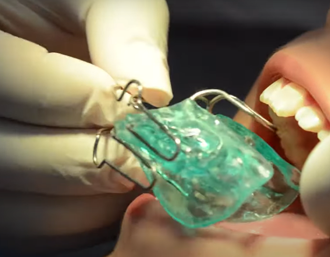 ortopedia-dental-aparatos